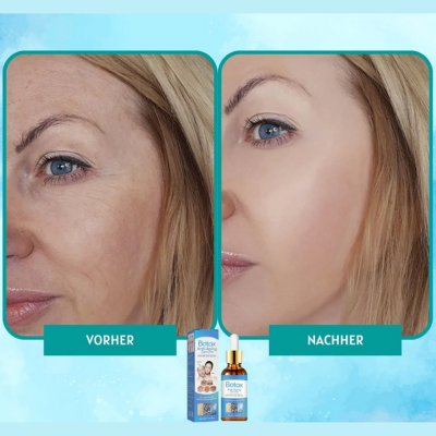 YouthGlow™ | Botox Antialterung Serum | 1+1 GRATIS
