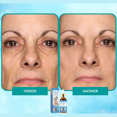 YouthGlow™ | Botox Antialterung Serum | 1+1 GRATIS