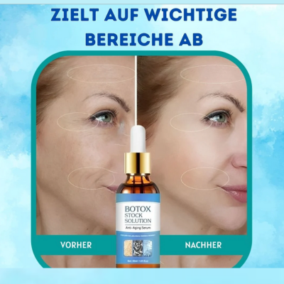 YouthGlow™ | Botox Antialterung Serum | 1+1 GRATIS