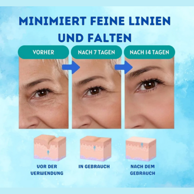 YouthGlow™ | Botox Antialterung Serum | 1+1 GRATIS