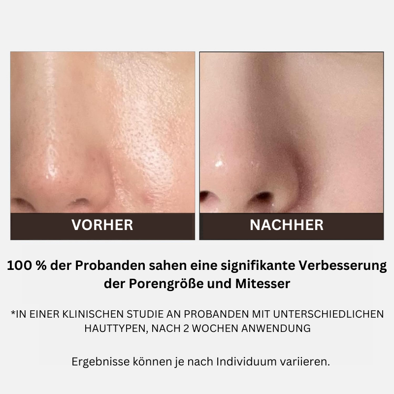 Zero Pore Pads