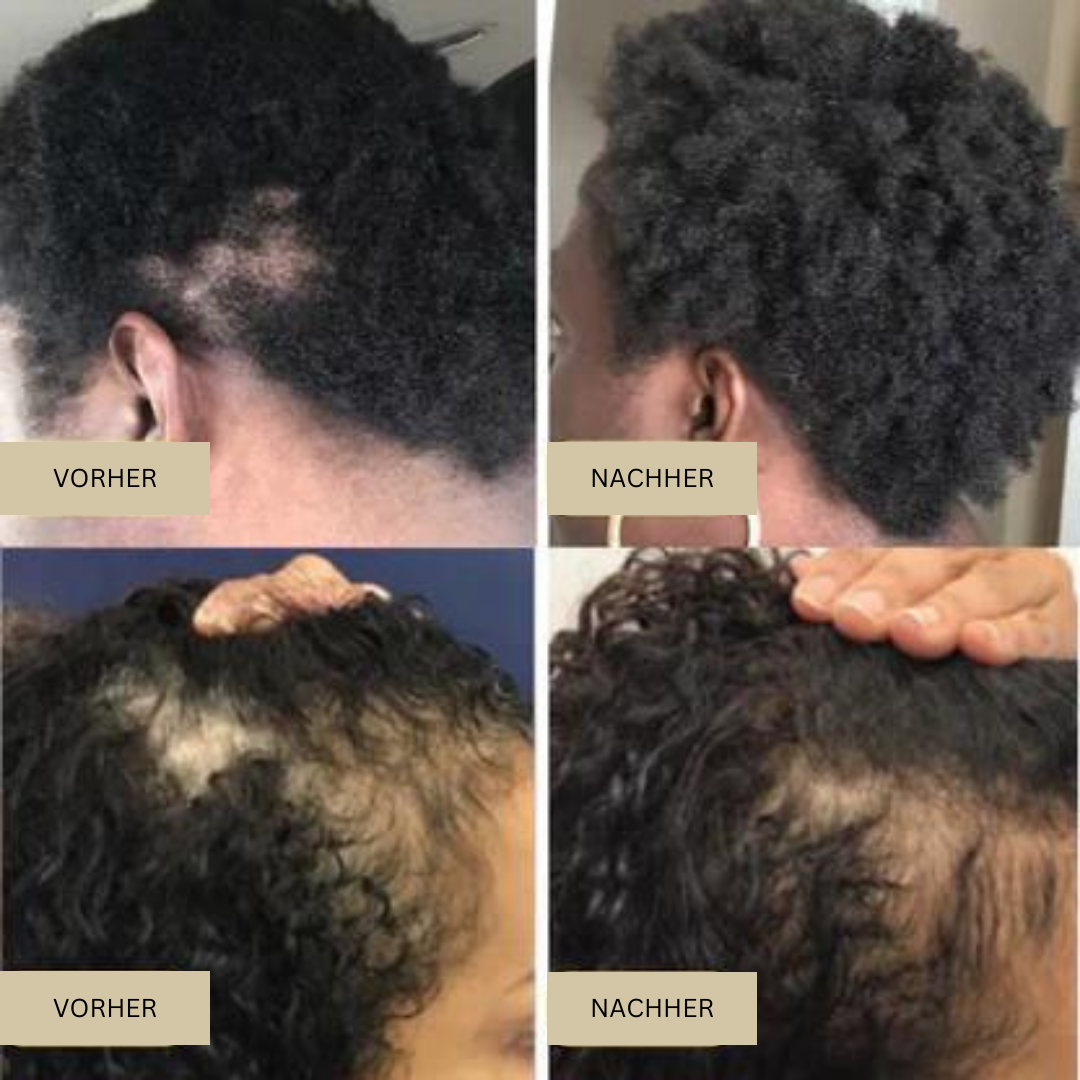 Biologisches Haarwachstumsöl