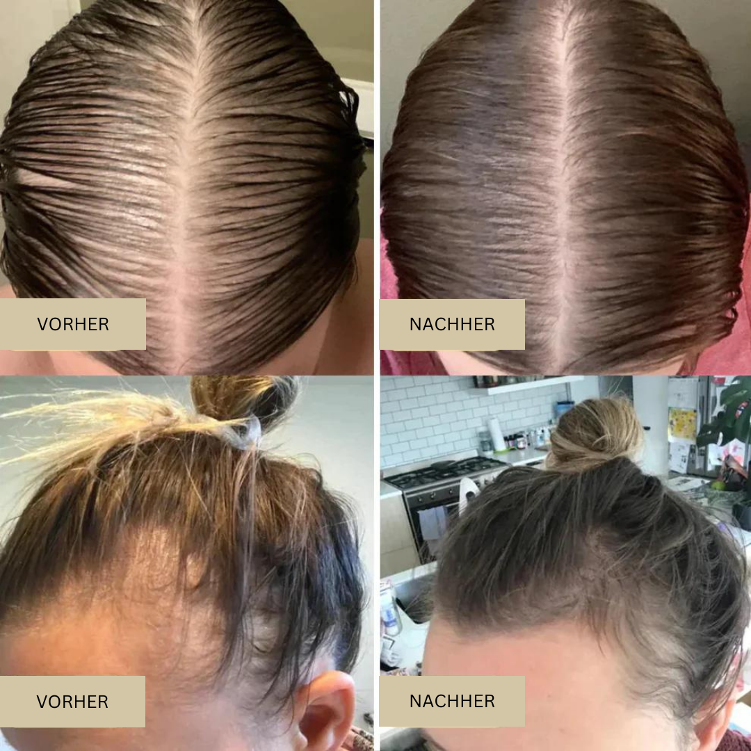 Biologisches Haarwachstumsöl