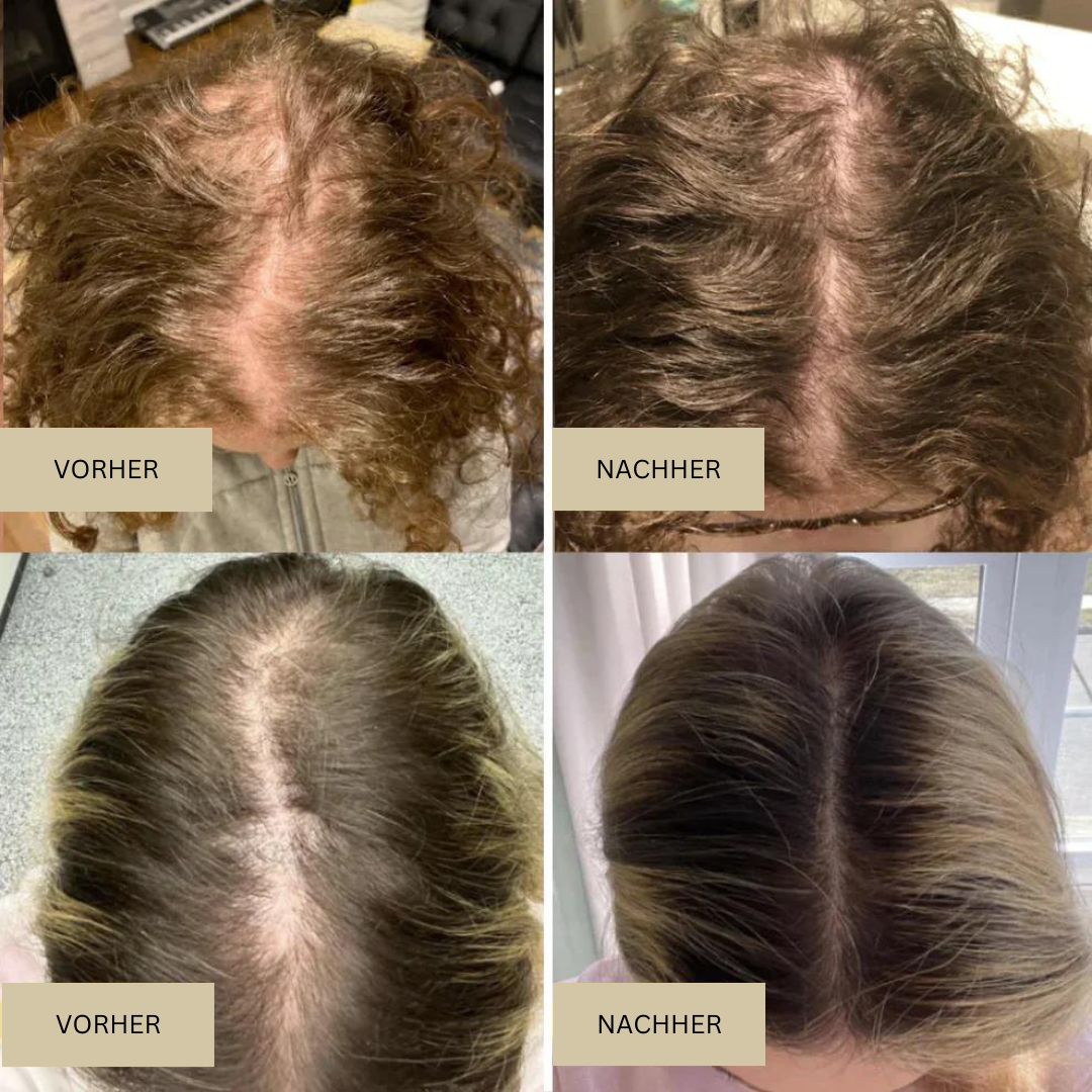 Biologisches Haarwachstumsöl