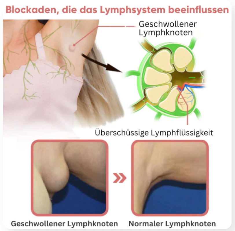LymphFlow™ Magnetogen