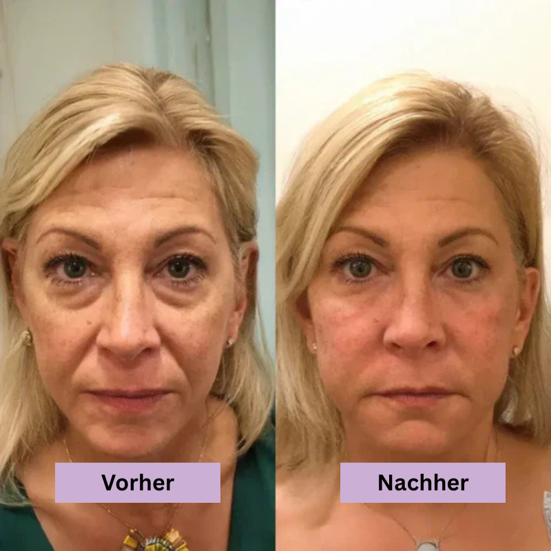Anti-Falten Augenpflege gegen Augenringe & Tränensäcke