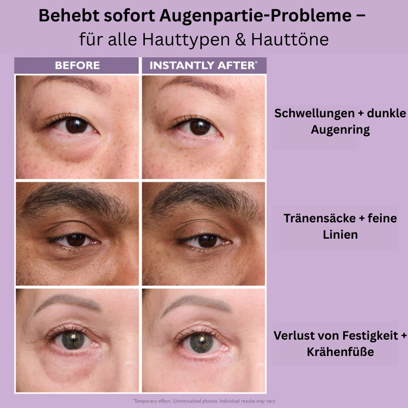 Straffe Augenlider und jugendlicher Blick