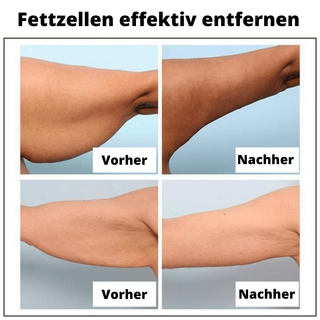 Heilsames Ingweröl - Beautyclam