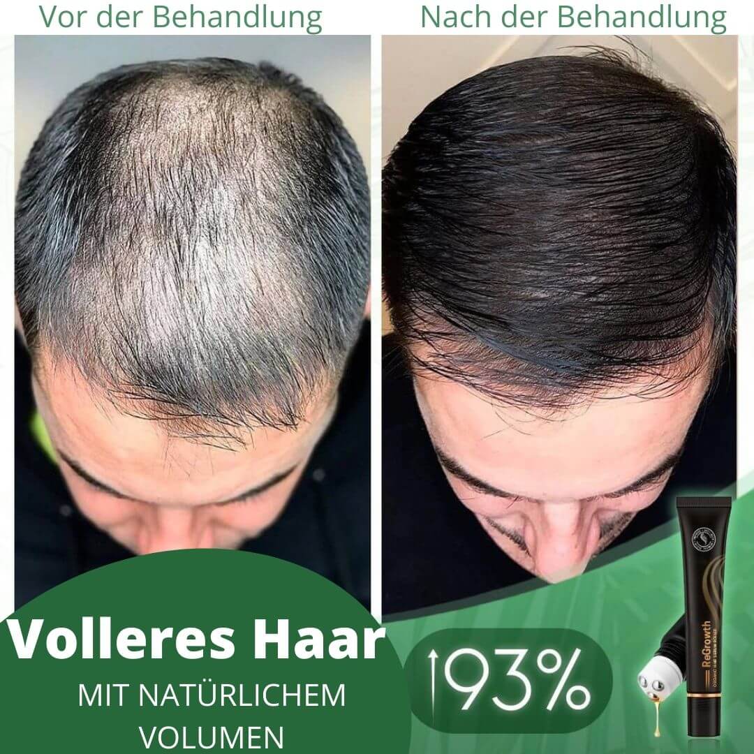 Regrowth™ Bio-Haarserum-Roller - Beautyclam Hair Care Wraps