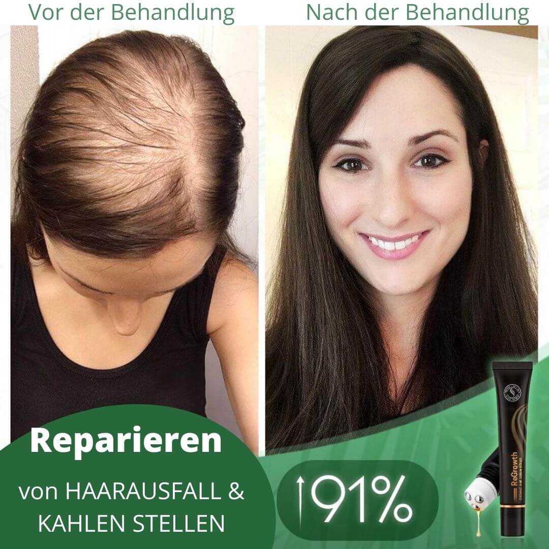 Regrowth™ Bio-Haarserum-Roller - Beautyclam Hair Care Wraps