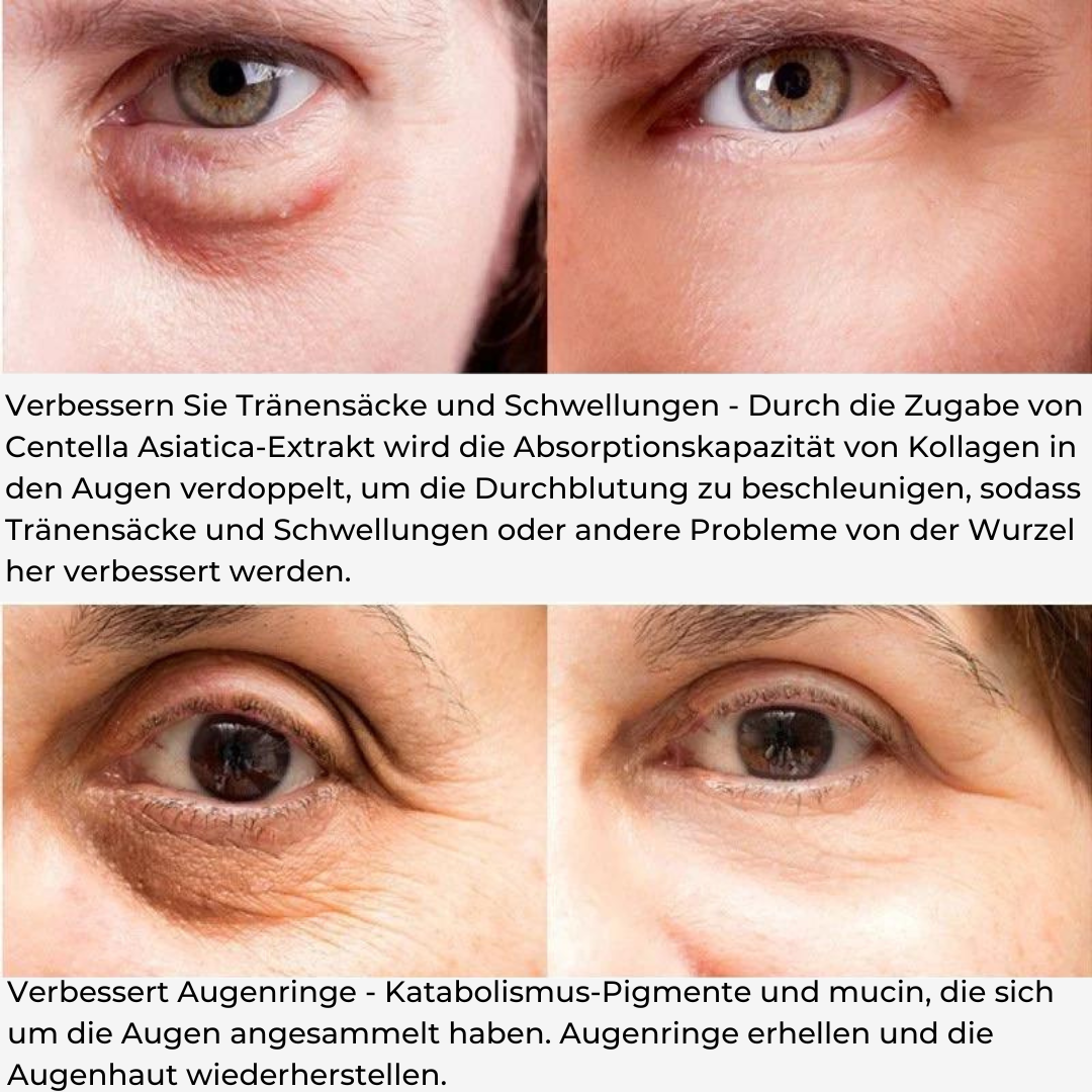 Anti-wrinkle Magic Eye Cream - Beautyclam Augen creme