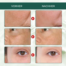 Load image into Gallery viewer, EELHOE Anti-Aging Serum - Beautyclam Anti-Aging Skin Care Kits
