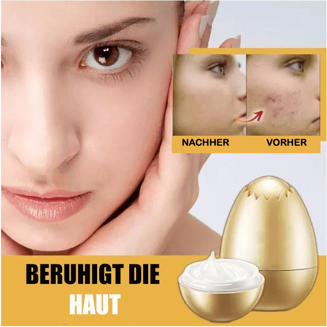 Gold Eiermaske - Beautyclam