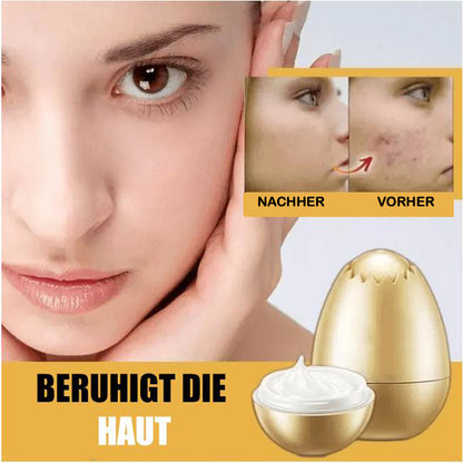 Gold Eiermaske - Beautyclam