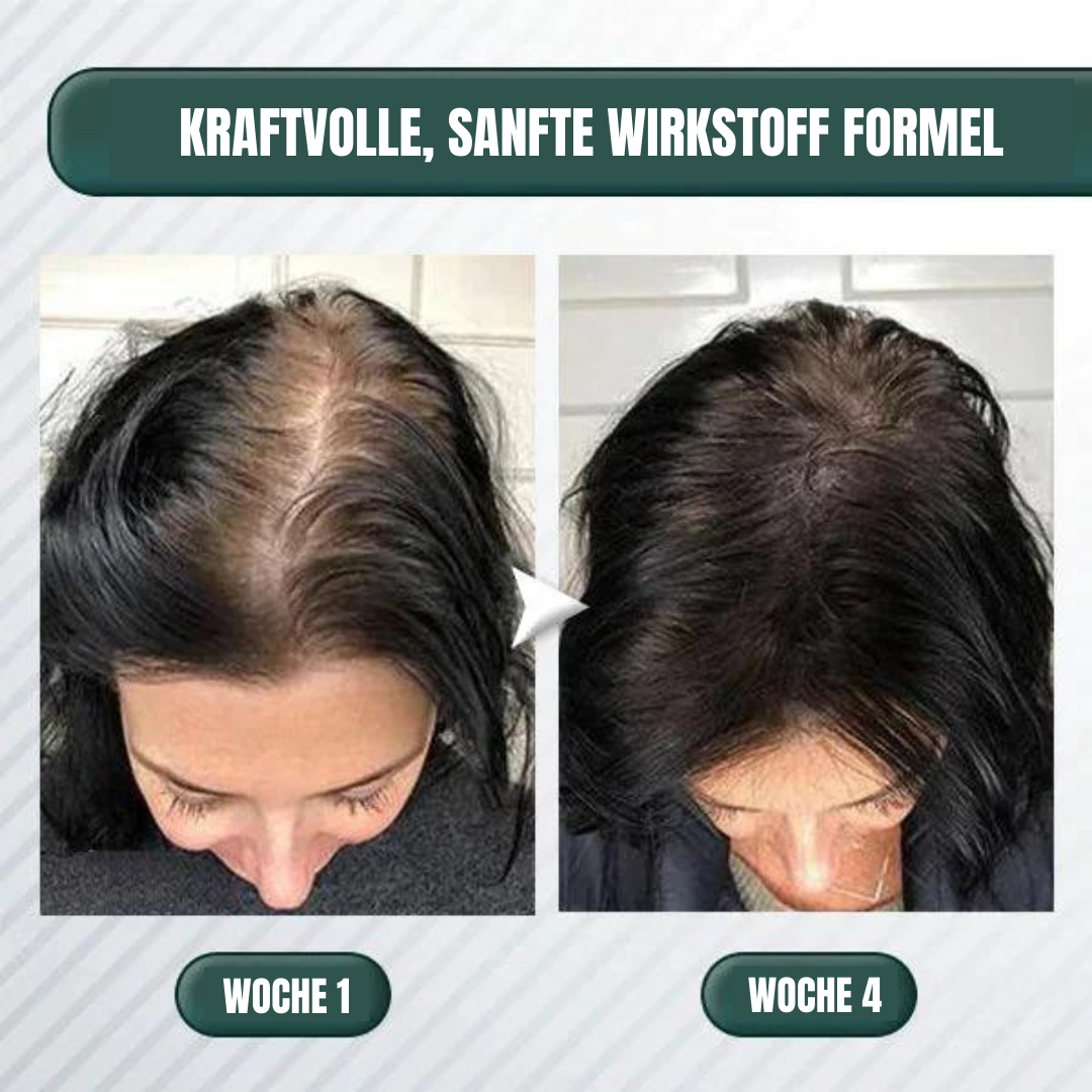 Hair Regrowth Centella Purifying Scrub Scalp 200g - Beautyclam Hair Care