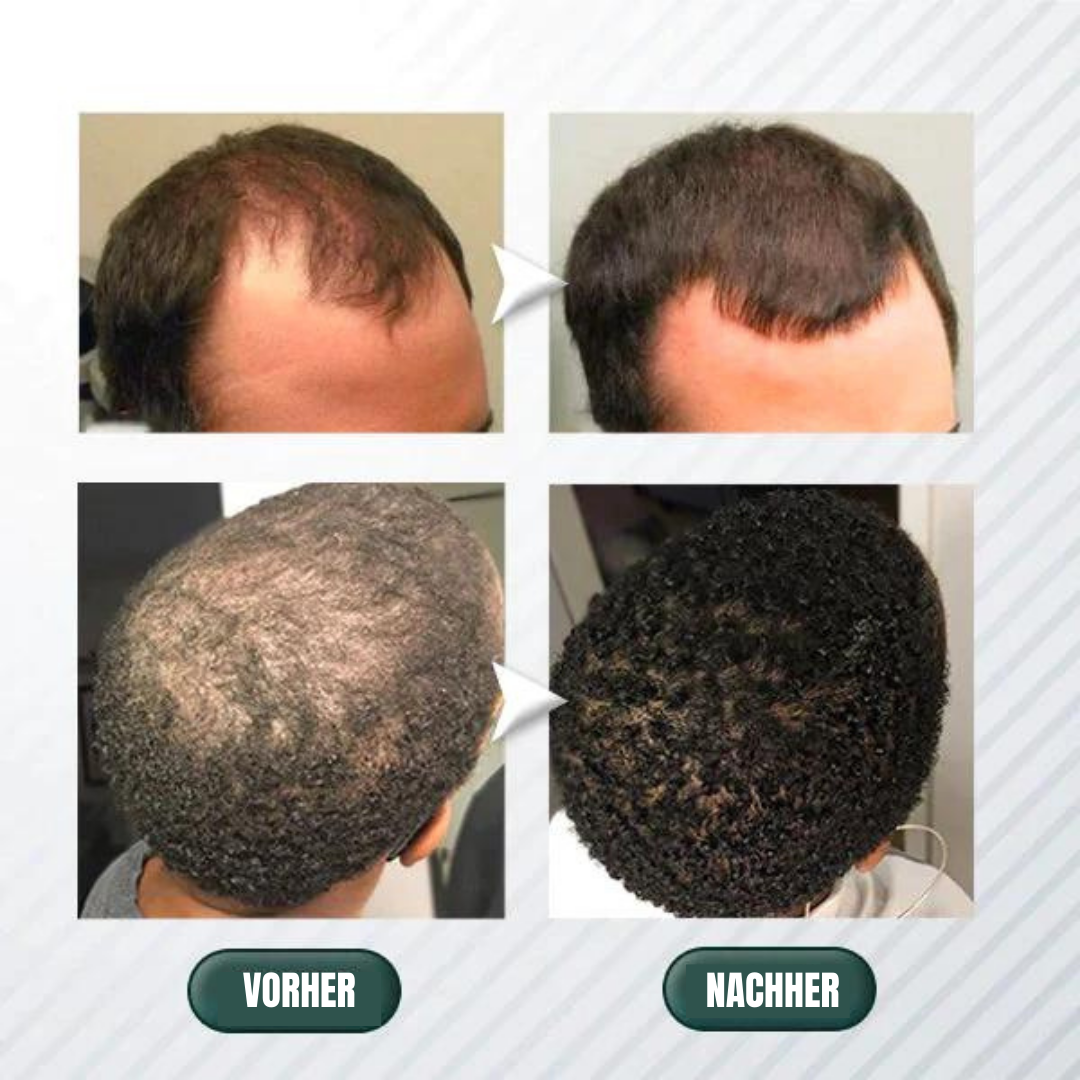 Hair Regrowth Centella Purifying Scrub Scalp 200g - Beautyclam Hair Care